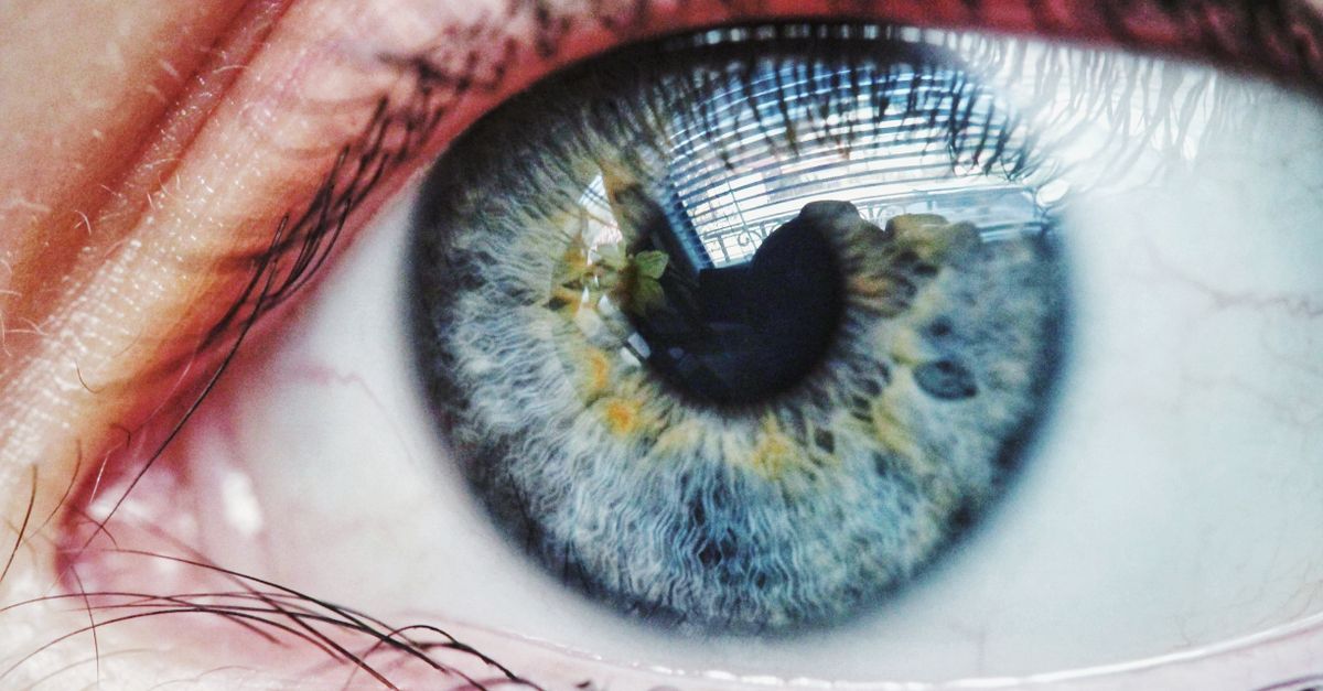 Keratoconus
